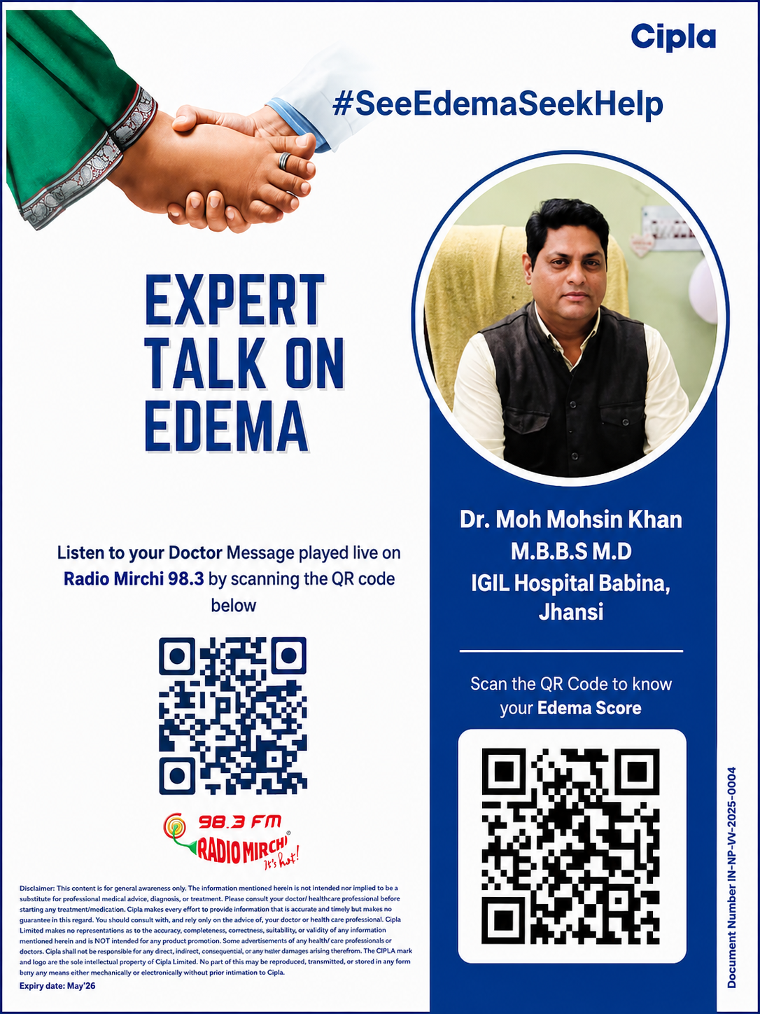 Cipla edema awareness expert talk feature